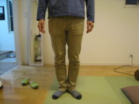 O脚矯正　脛の痛み