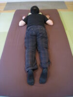 30代で変形性膝関節症